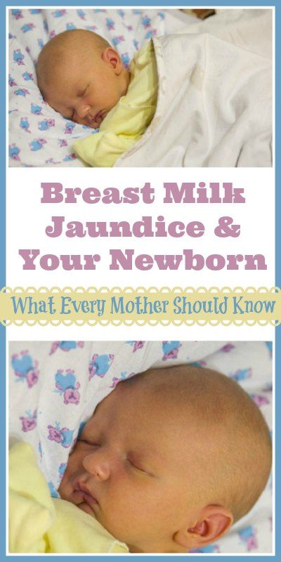 Baby Sleep Treatment: Breast Milk Jaundice & Your Newborn