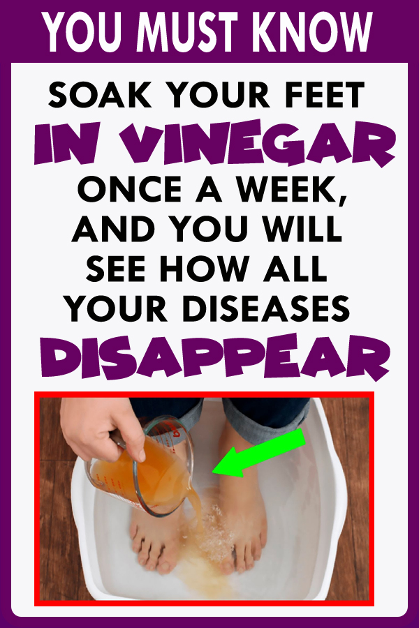 SOAK YOUR FEET IN VINEGAR ONCE A WEEK, AND YOU WILL SEE HOW ALL YOUR