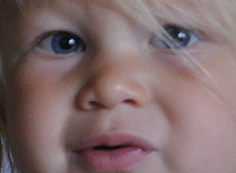 a sweet life Busted Lip