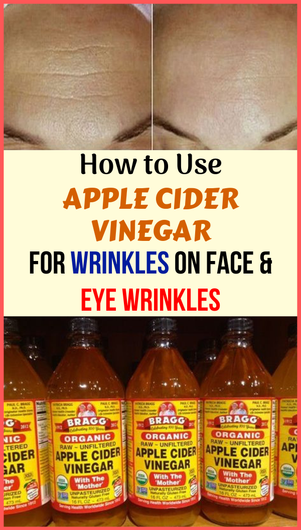 How to Use Apple Cider Vinegar for Wrinkles on Face & Eye Wrinkles