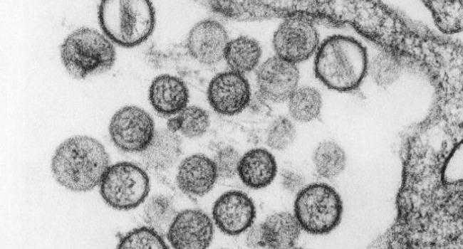 Hantavirus Hantavirus
