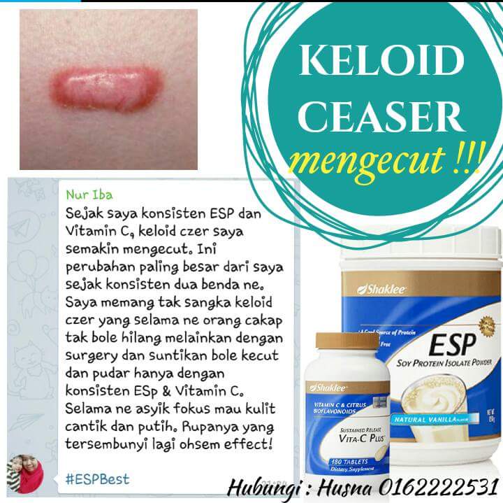 Cara menghilangkan keloid yang dah bertahuntahun Cantik Sihat Corner