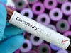 बिग ब्रेकिंग: शहडोल में  एक साथ 11 लोग कोरोनावायरस पॉजिटिव