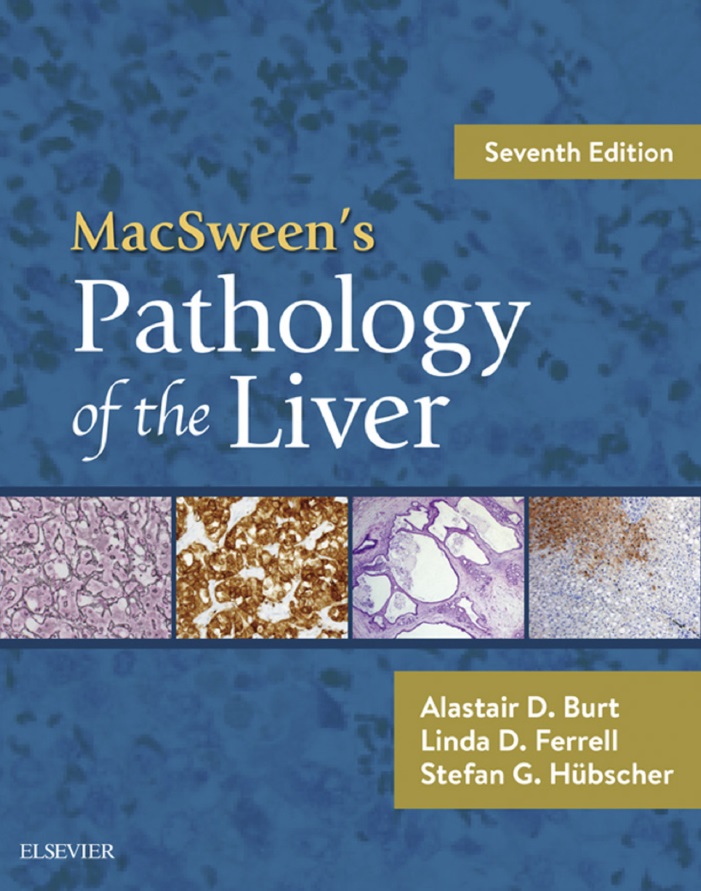 MacSween’s Pathology of the Liver,7th Edition