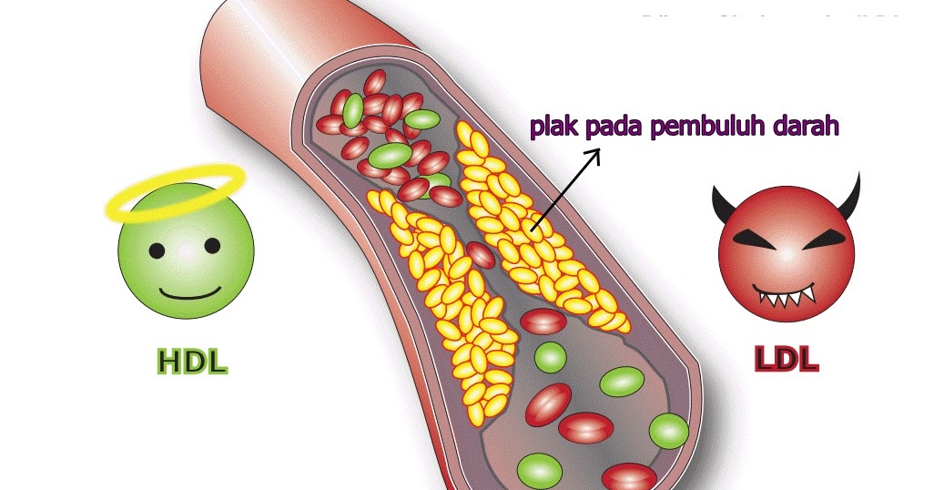 Colesterol hdl bajo que significa