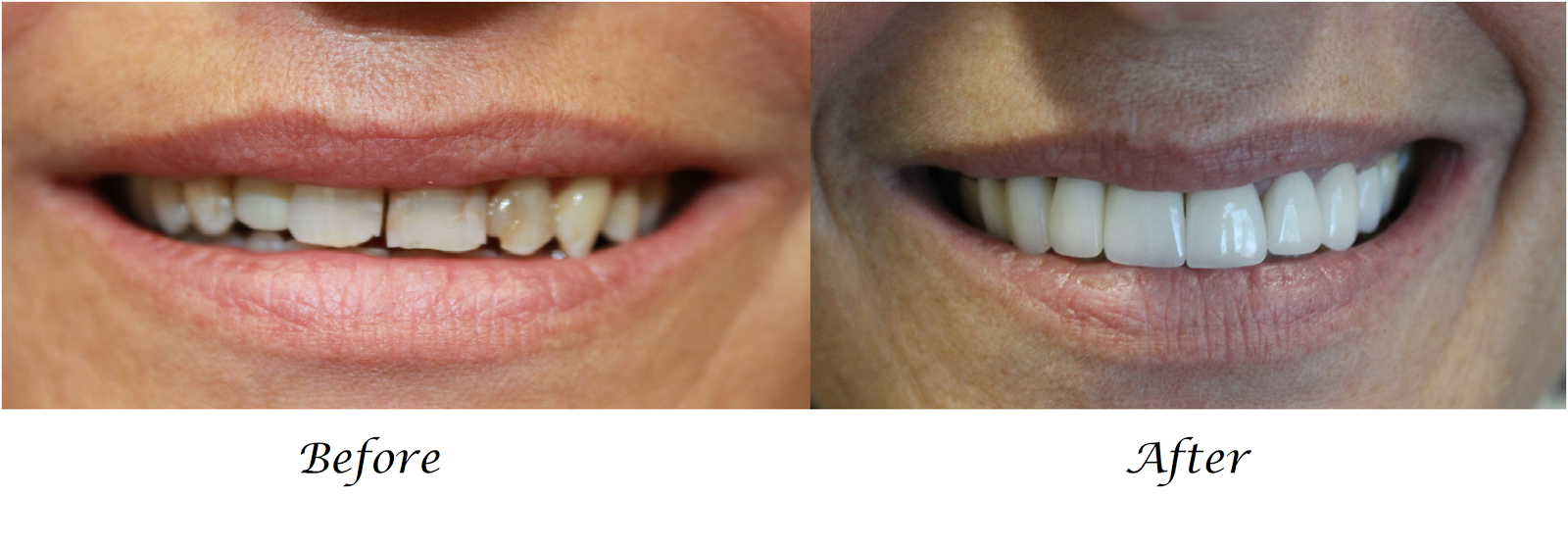 Kingsland Dental Blog Dentist in Katy Tx What is Cosmetic Dentistry?