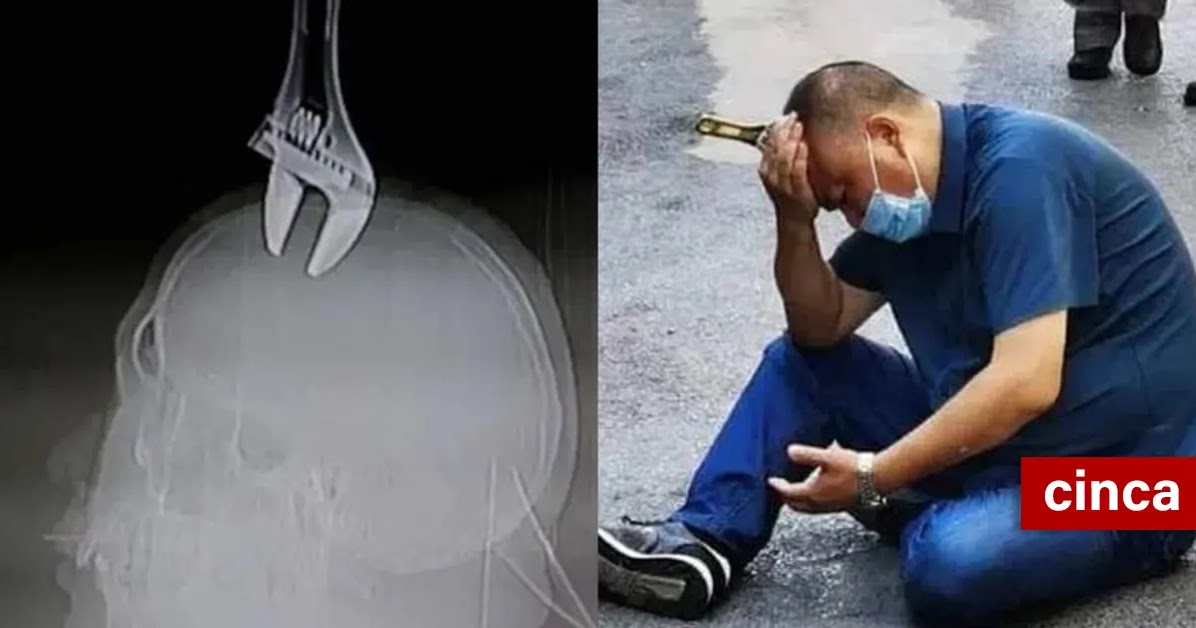 9+ Arti Mimpi Kotoran Jatuh Di Atas Kepala