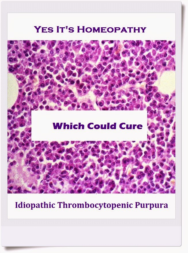 itp disease is curable itp disease is curable