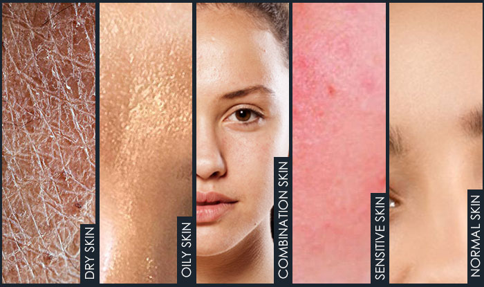 types of skin