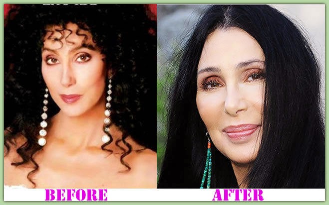 Plastic Surgery Bra Size: May 2014