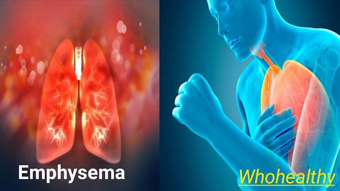 Emphysema : Symptoms and Causes - Whohealthy