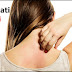 Cara Mengobati Dermatitis Secara Cepat dan Mudah
