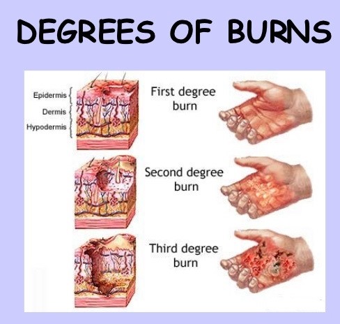 Study Medical Photos: A Brief Description Of Burns