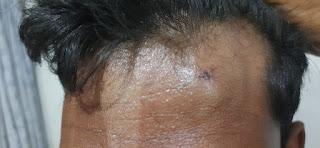 बरमकेला टीआई द्वारा थाने बुलाकर मारपीट करने का गंभीर आरोप, पीड़ित परिवार ने पुलिस अधीक्षक से लगाई न्याय की गुहार ... 4 IMG 20210708 WA0009
