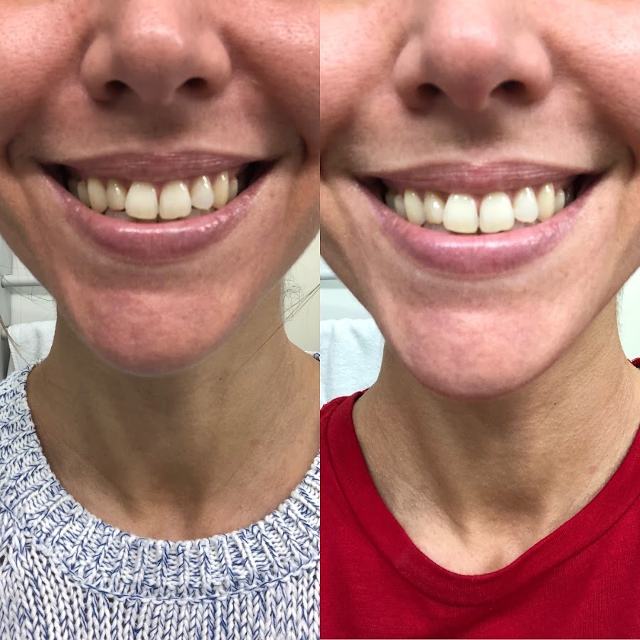 Fitness and Chicness-Innovawhite-2