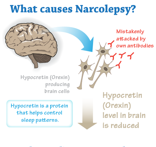 sleep cataplexy