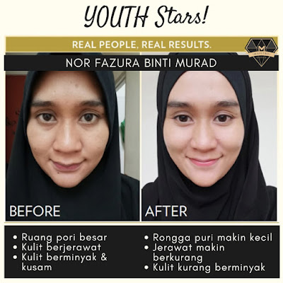 TESTIMONI YOUTH SKINCARE: PEMENANG PERTANDINGAN YOUTH STAR 