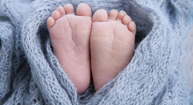 4 Tahun Dirawat di RS Sardjito, Bocah Kembar Siam asal Aceh Dibolehkan Pulang Desember 4, 2019