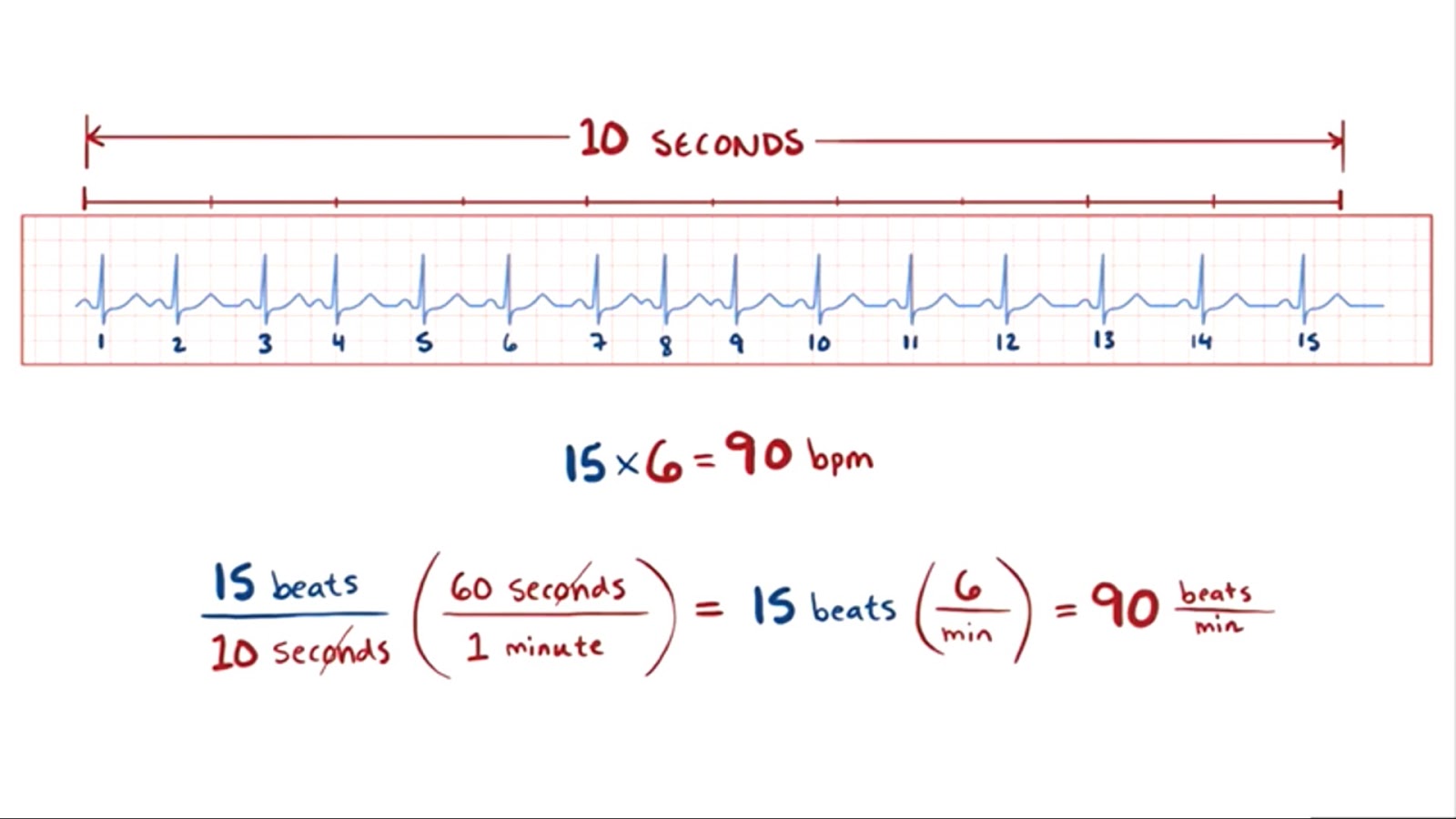 Ekg Ders 3 Nabiz Hizi Hesaplama Ve Duzensiz Ritmi Tanima