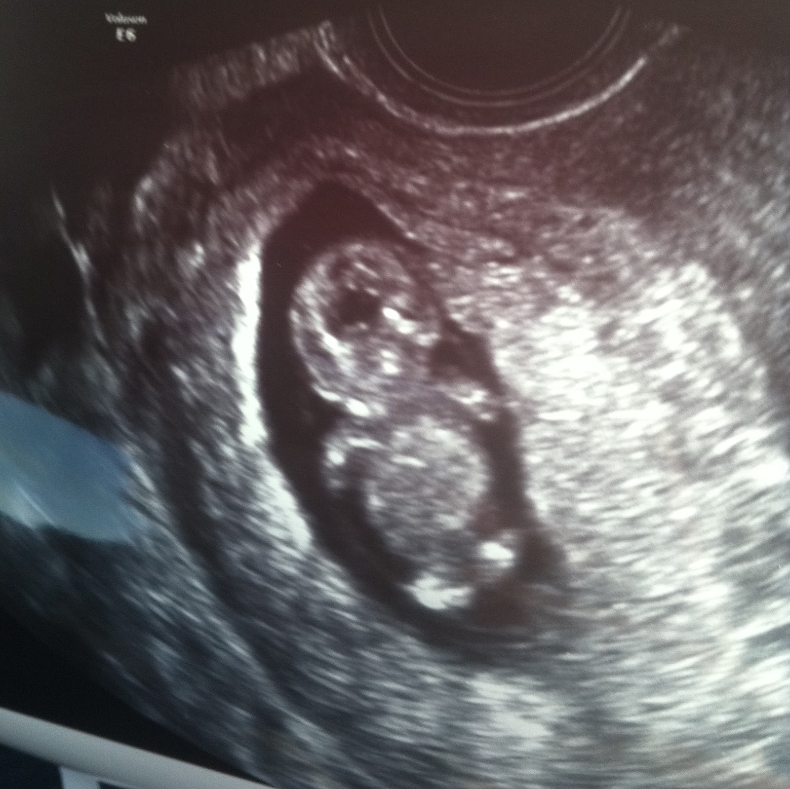 10 Weeks