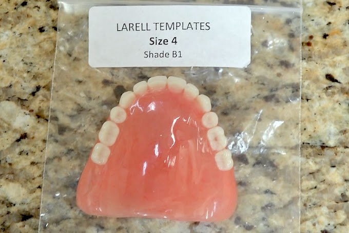 PROSTHODONTICS: Larell One Step Denture - Dr. Cutbirth