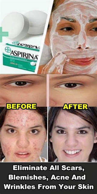 Homemade Peeling with Aspirin To Eliminate All Scars, Blemishes, Acne And Wrinkles From Your Skin