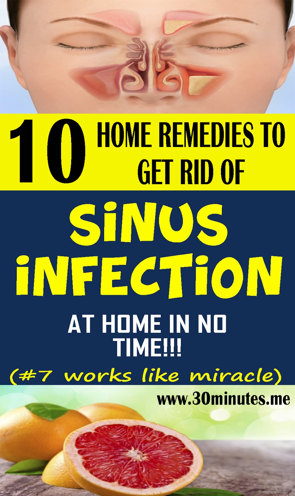 what meds help a sinus infection