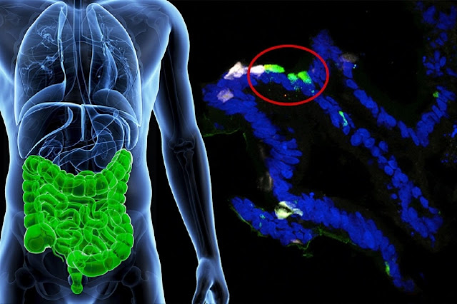 Исследователям удалось «научить» клетки кишечника человека вырабатывать инсулин