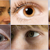 If You See These Unusual Things In Your Eyes, Better See Your Doctor Before It's Too Late