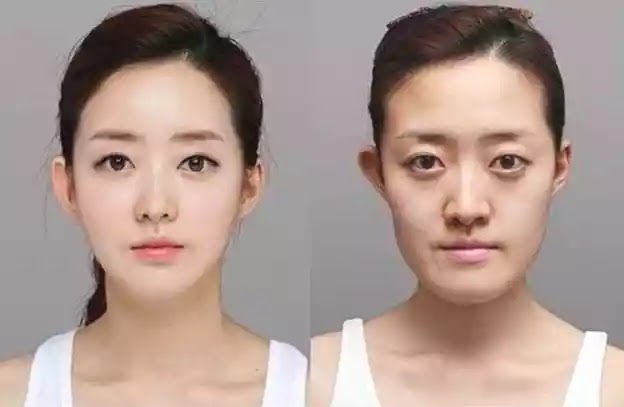 The Negative Effects Of Cosmetic Plastic Surgery