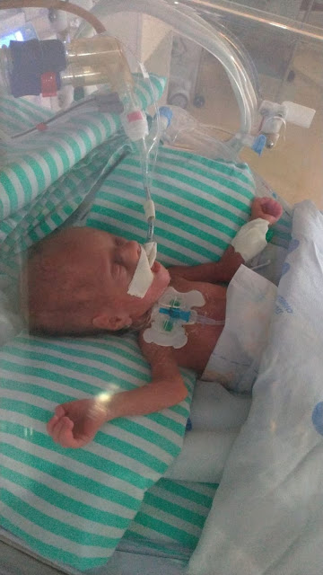 Bebê diagnosticado com Covid-19 ao nascer tem alta de hospital em Maceió cinco meses depois
