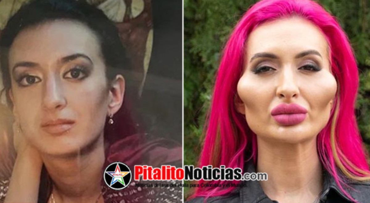 Mujer con los pómulos más grandes busca conseguir récord Mundial