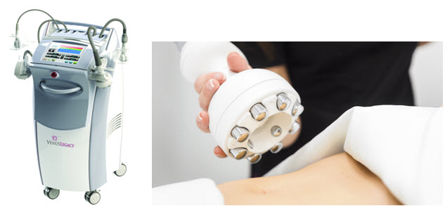 Venus Legacy noninvasive skin tightening device