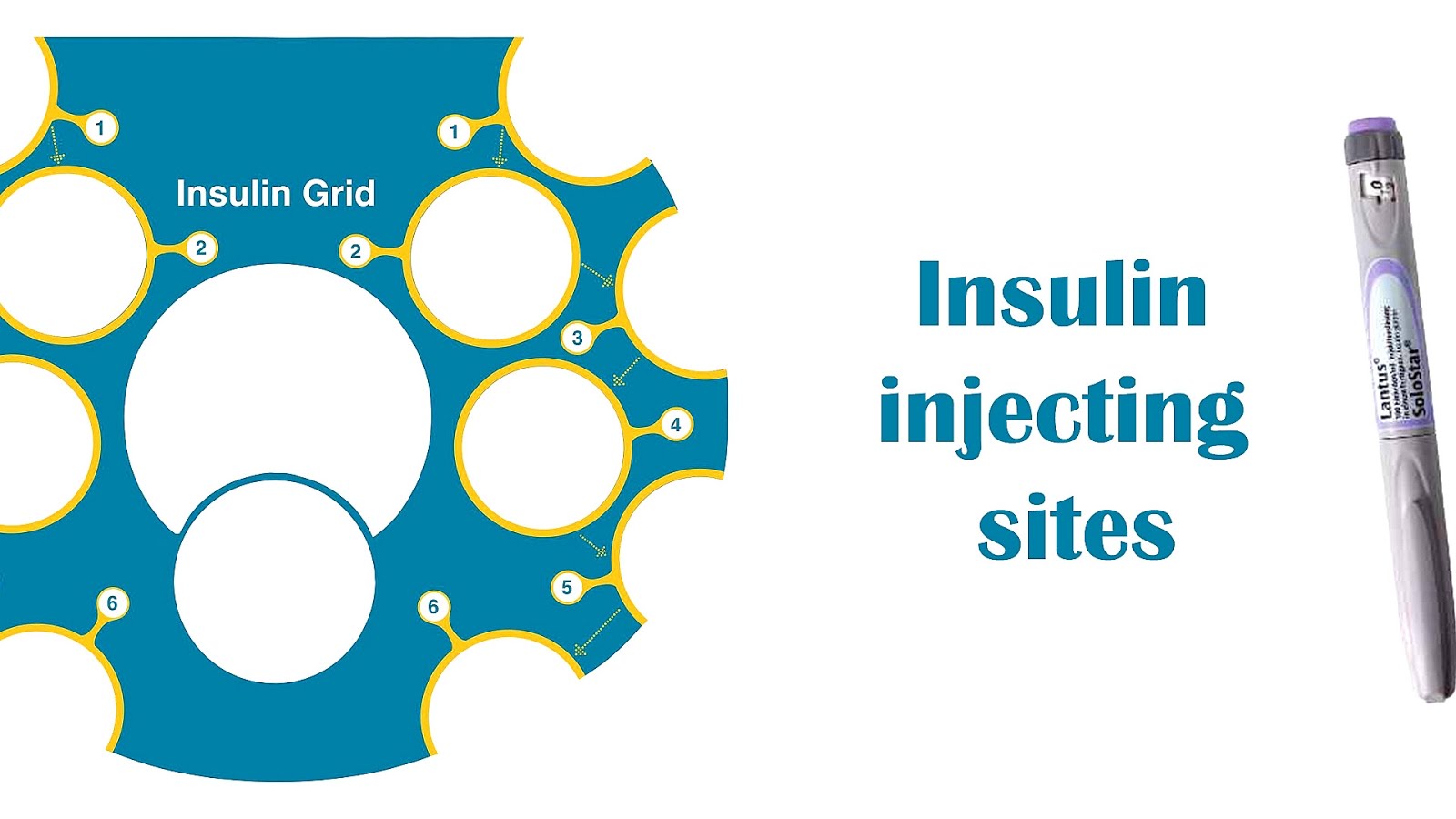 Subcutaneous injection Insulin Sites Insulin Choices