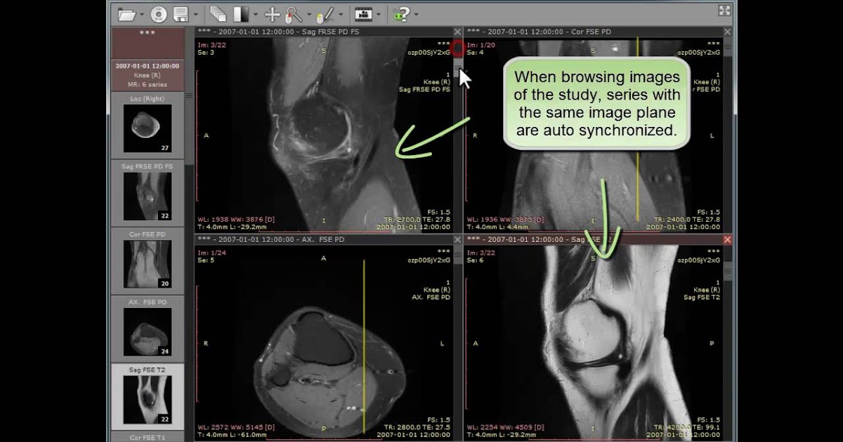 Dicom viewer download windows 10
