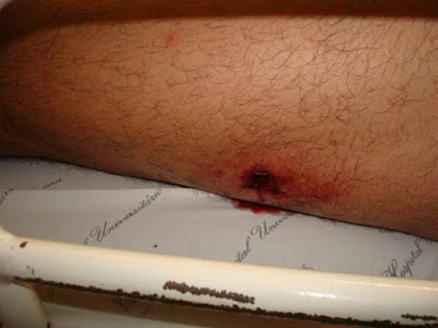 Mototaxista é baleado e tem moto roubada no Bairro Esperança da Comunidade