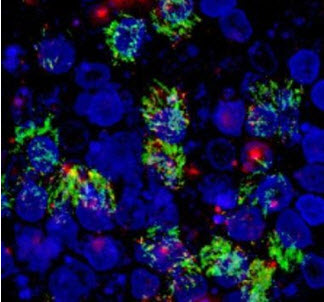 Microscope image shows TIM-1 expression (in green) on the surface of human airway cells