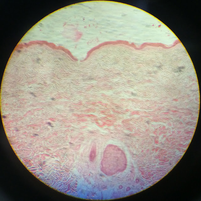 histology slide of thin skin