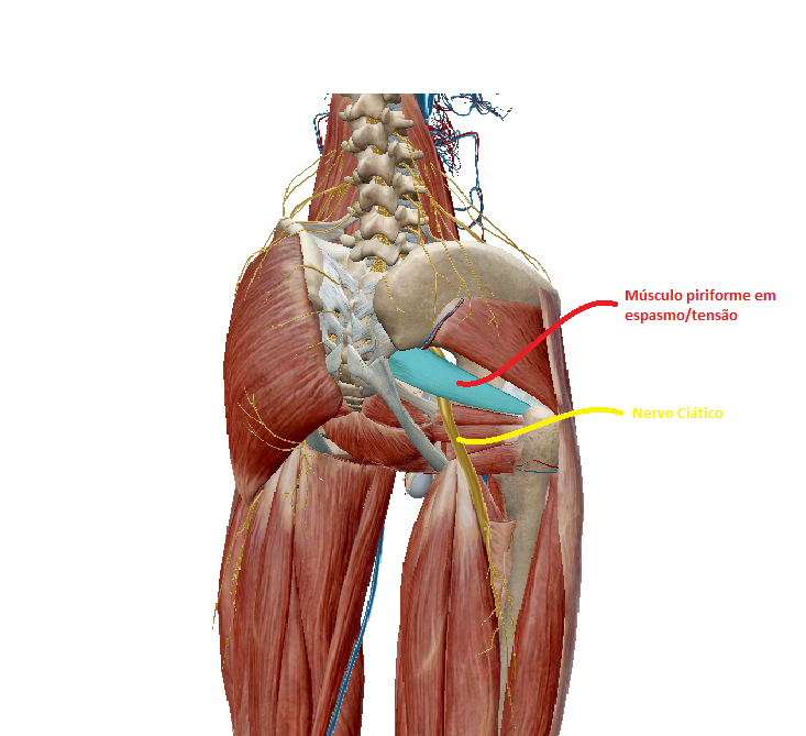 piriforme1.gif