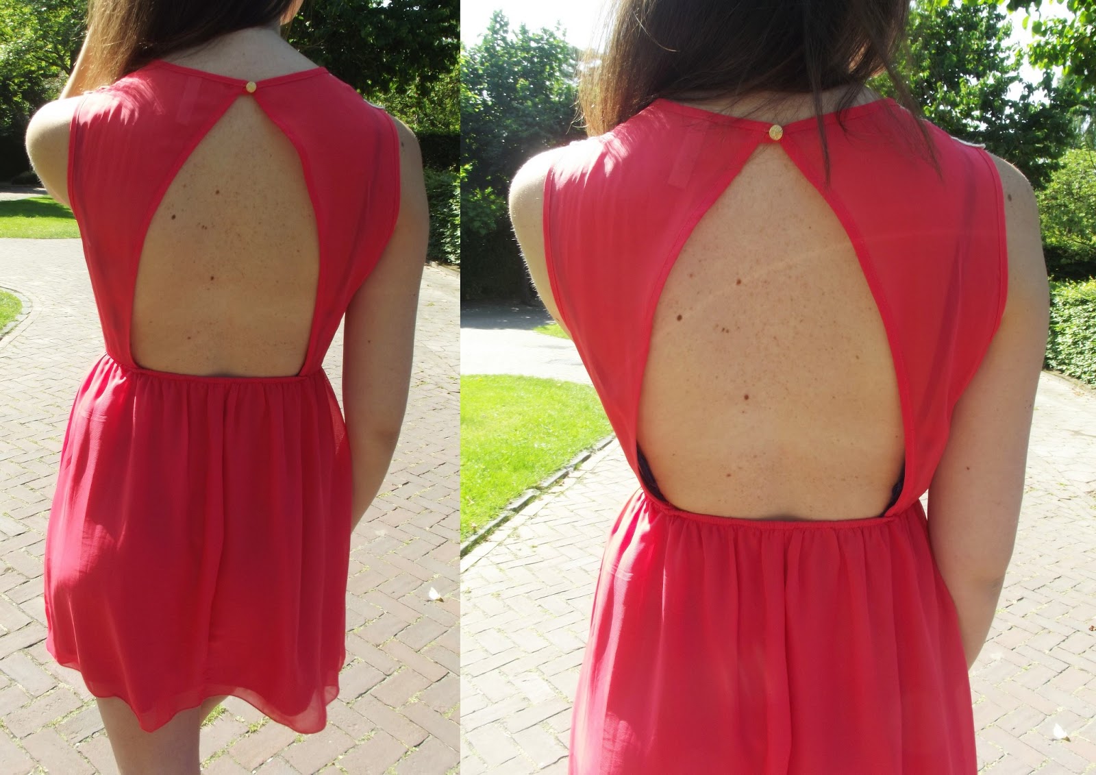 VLuxury DIY VLuxury Backless bra