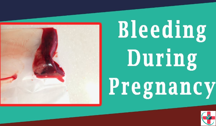Pregnant and experiencing very light bleeding