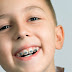 Niềng răng cho trẻ em có khó không?