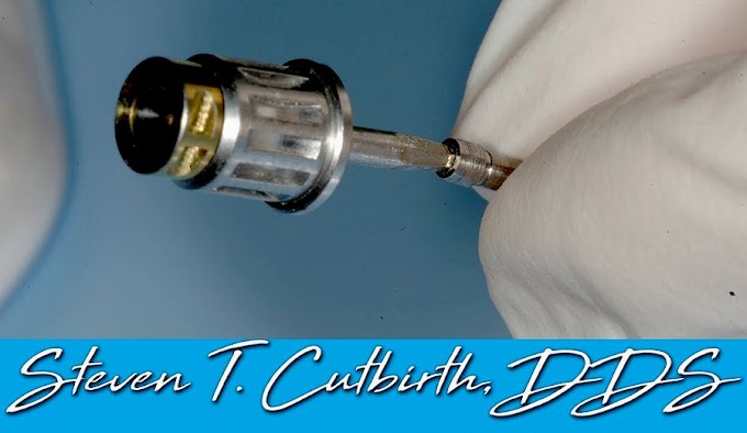 IMPLANTOLOGY: Implant Screw Slipping when Torquing - Dr. Cutbirth