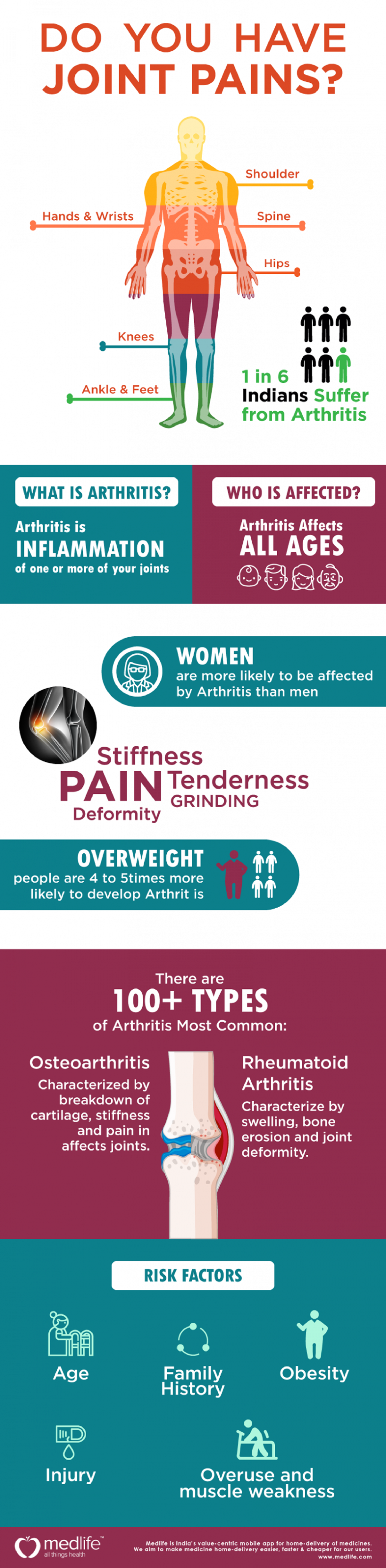 Do you have Joint Pains? [Arthritis] #infographic