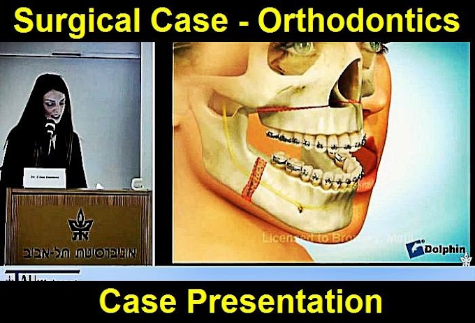 CASE PRESENTATION: Surgical Case - Orthodontics