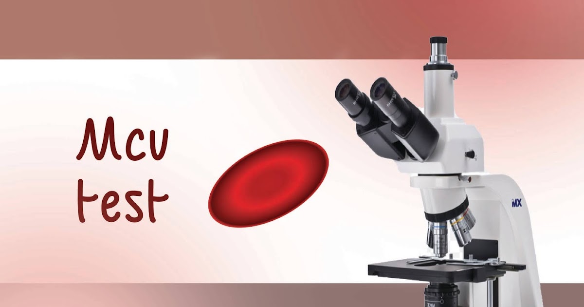 اختبار ماكف