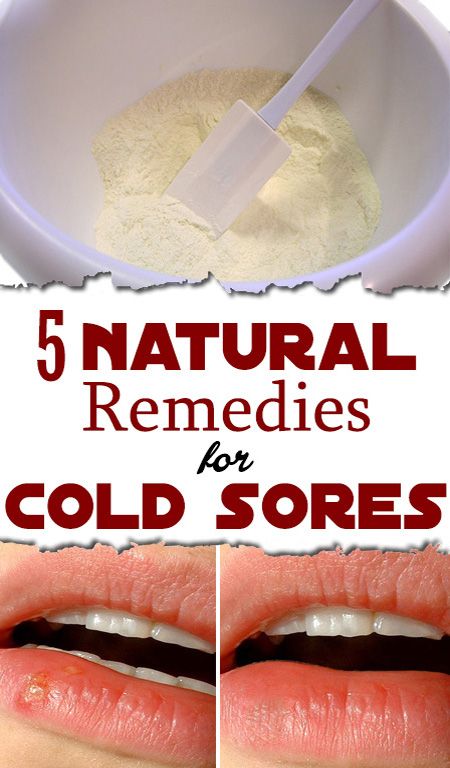 5 Natural Remedies For Cold Sores Beautiful Diy And Health
