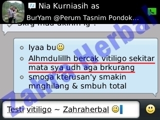 Cara Cepat Menghilangkan Vitiligo dengan Ampuh Cara Cepat Menghilangkan Vitiligo dengan Ampuh
