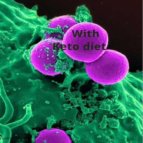 Comment traiter le cancer : Régime cétogène Comment traiter le cancer : Régime cétogène