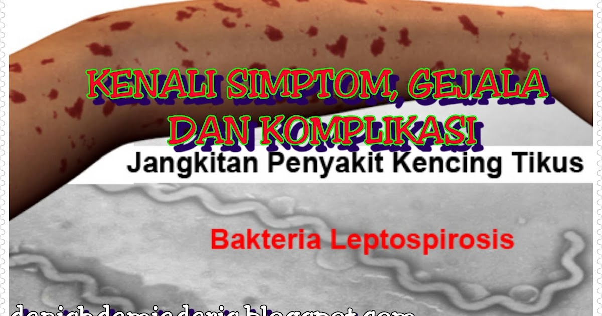 KENALI SIMPTOM GEJALA DAN KOMPLIKASI PENYAKIT KENCING KENALI SIMPTOM GEJALA DAN KOMPLIKASI PENYAKIT KENCING